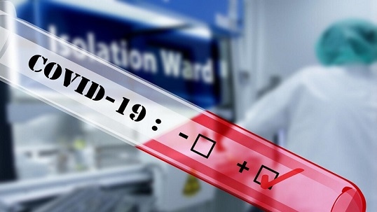 3475 доказани с COVID-19 за денонощие