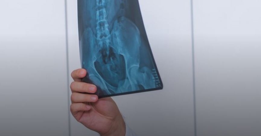 Лекар опита да оперира жена заради счупване, което не съществува