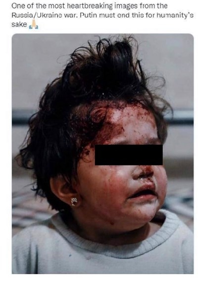 Представиха снимка на ранено сирийче за украинче