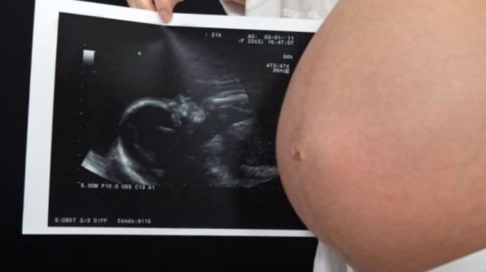 Държавата ще плаща прегледа и приема в болница на бременни жени без здравни осигуровки