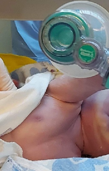 Жена  с тежка сърдечна малформация роди здраво бебе