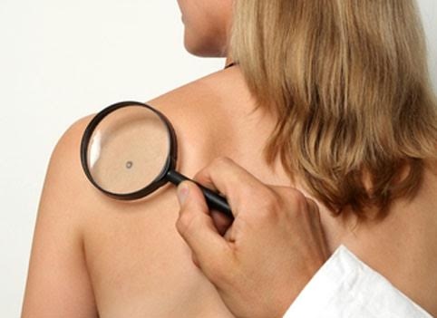 Безплатни прегледи при дерматолозите във ВМА