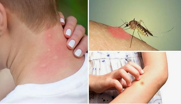 Какво ме ухапа и как да реагирам