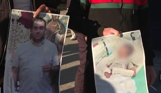 Дете осакатено от побой заради бране на джанки