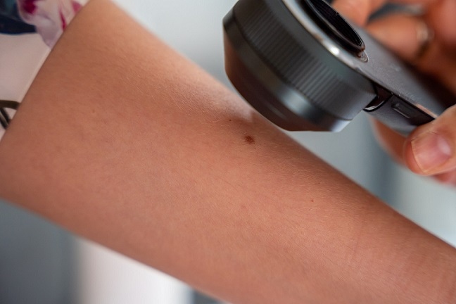 Безплатни прегледи на бенки в три града