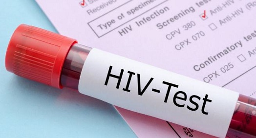 В периода 23-30 ноември 2018 г. отбелязваме Европейска седмица на тестването за ХИВ и вирусни хепатити. Тази година, за 30-ти пореден път ще отбележим и 1-ви Декември - Световен ден на СПИН под мотото „Узнай своя статус